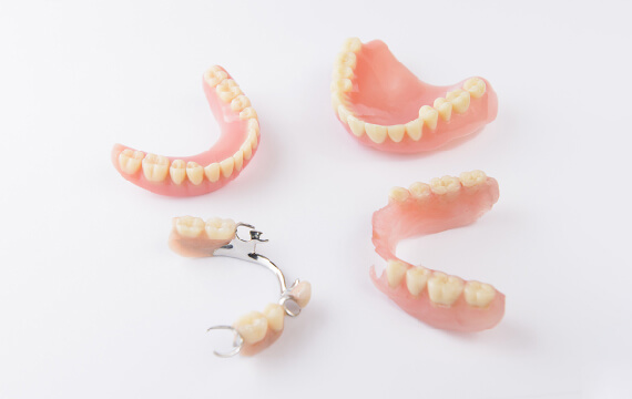 詰め物・被せ物