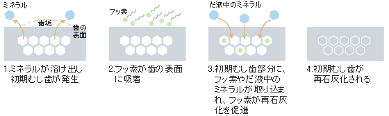 フッ素の効果
